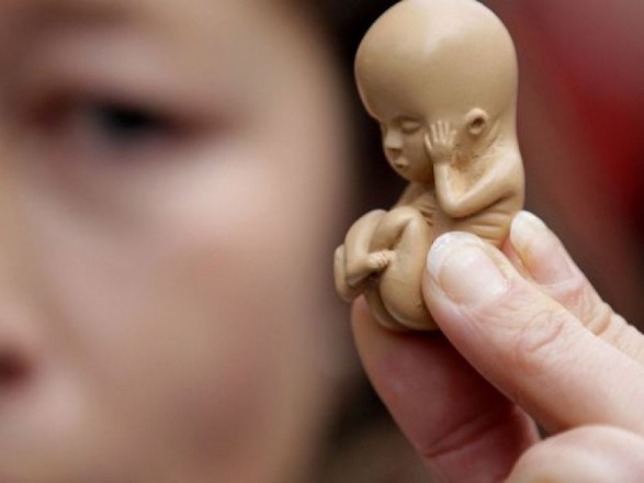 В Украине почти 400 несовершеннолетних в прошлом году сделали аборты