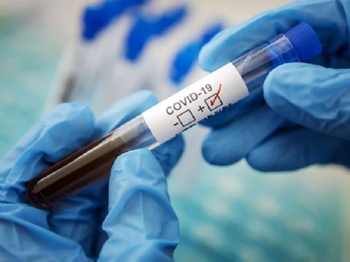 В Институте эпидемиологии рекомендуют проверить антитела к коронавирусу до и после прививки от COVID-19