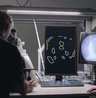 В Google создали микроскоп дополненной реальности для диагностики рака