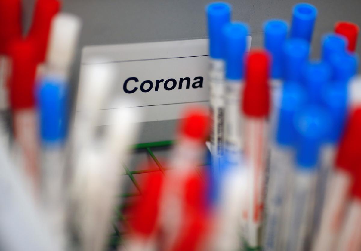 У Львові розпочали високоточне ІФА-тестування на антитіла до коронавірусу