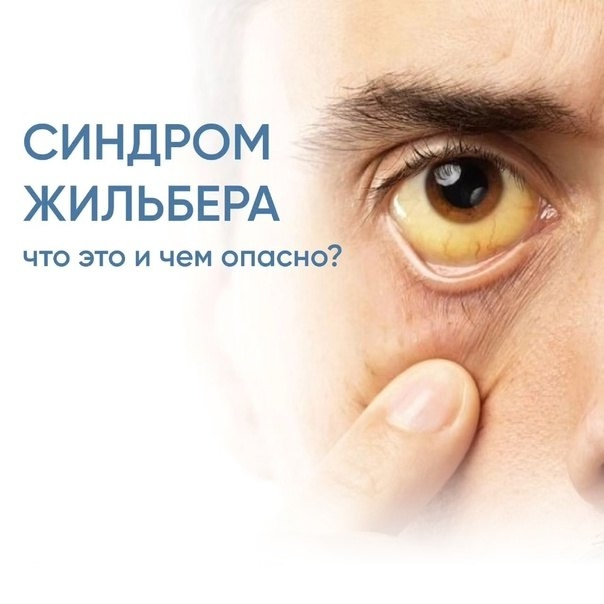 Синдром Жильбера у детей, особенности течения